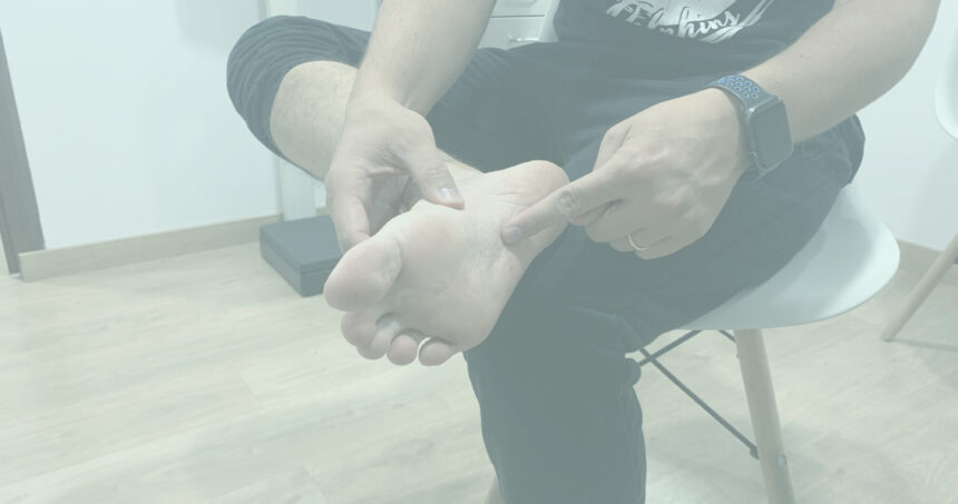 Fascitis Plantar: causas, síntomas y fisioterapia